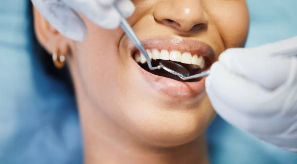 Best Emergency Dental Care for Broken or Chipped Teeth in Pomona Park, FL